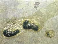 沙门氏菌样粪便